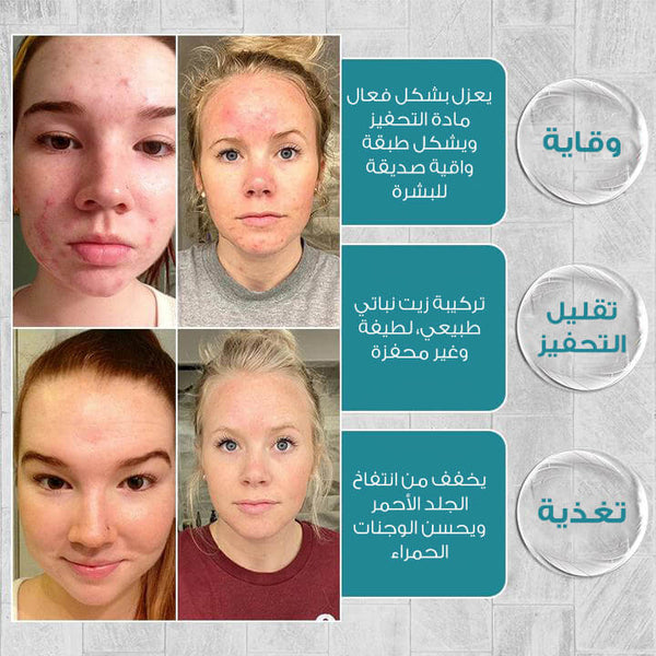 صابون ألياف بروتين الحرير 100 غرام لإصلاح البشرة 💫 تخفيض حصري 🎁